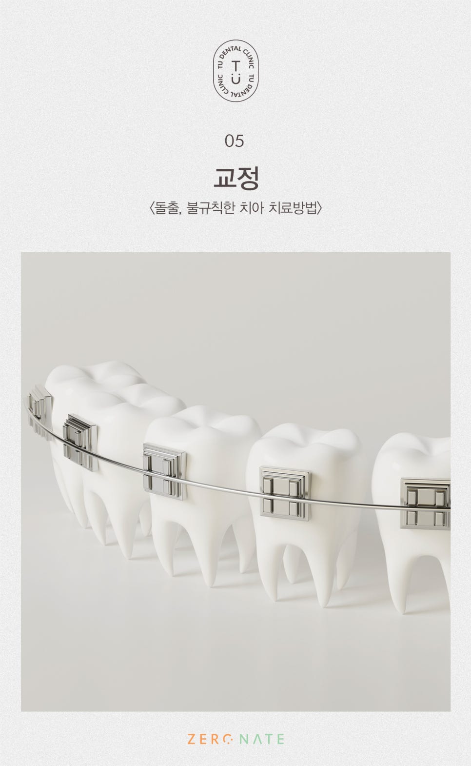 티유치과 돌출,불규칙한 치아 제로네이트[TU치과] 관련 이미지 6