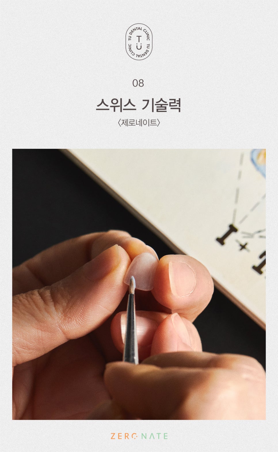 티유치과 옥니 치료법, 옥니에도 제로네이트 [TU치과] 관련 이미지 9