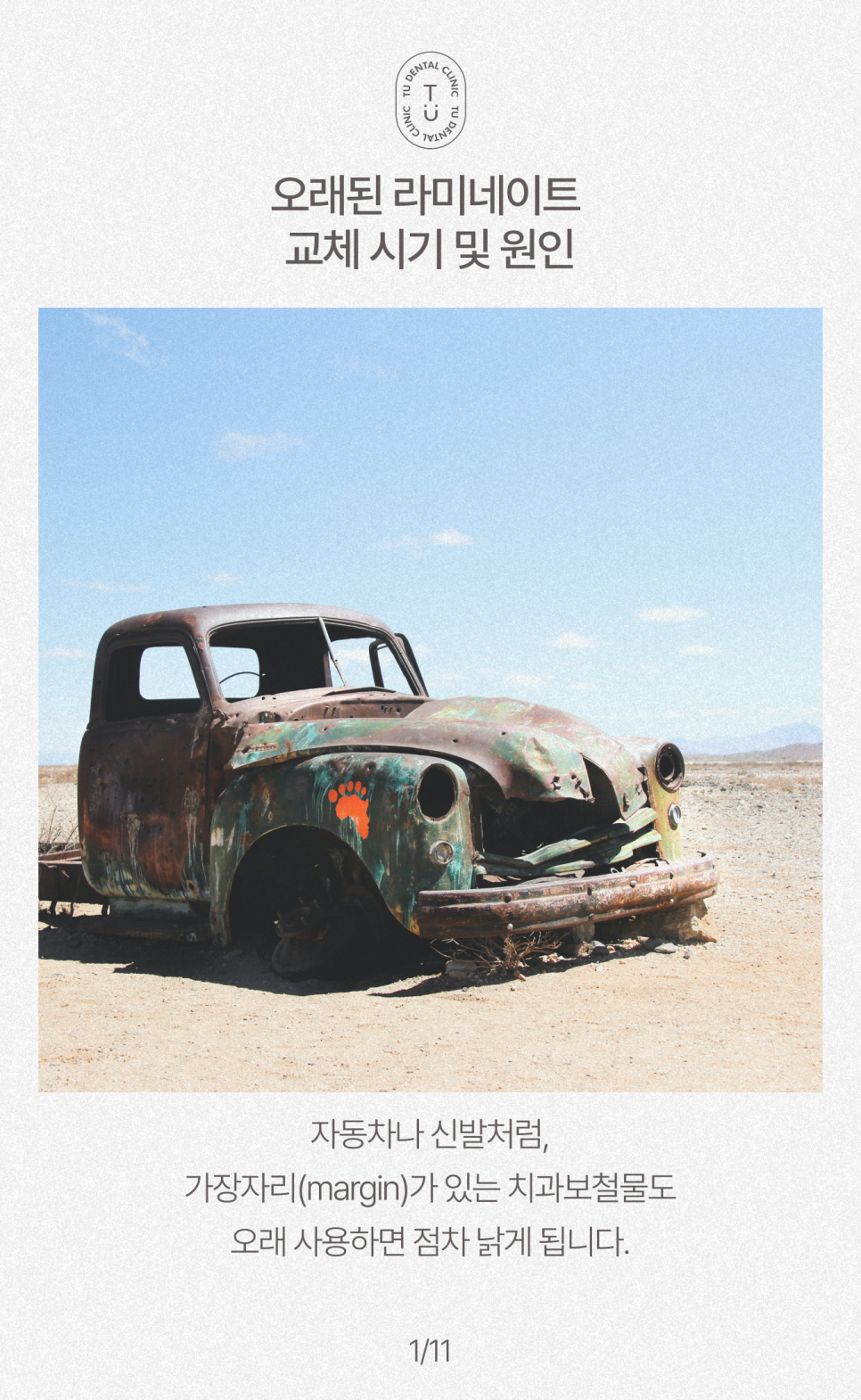 오래된 라미네이트 교체하셔야 됩니다, 티유치과[TU치과] 관련 이미지 2