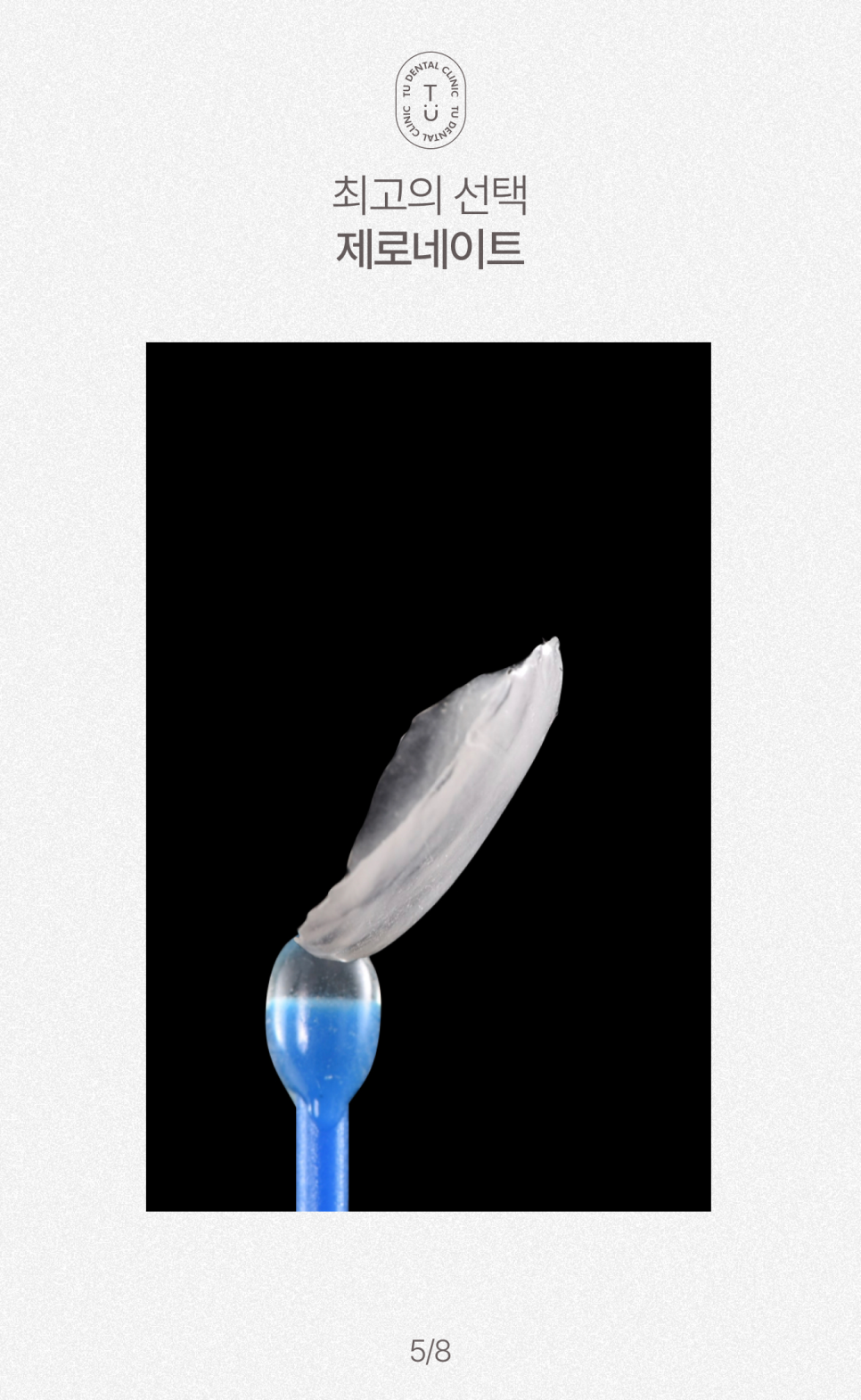 왜소치 치료방법, 작은치아 라미네이트, 제로네이트 알려드립니다! 티유치과[TU치과] 관련 이미지 6