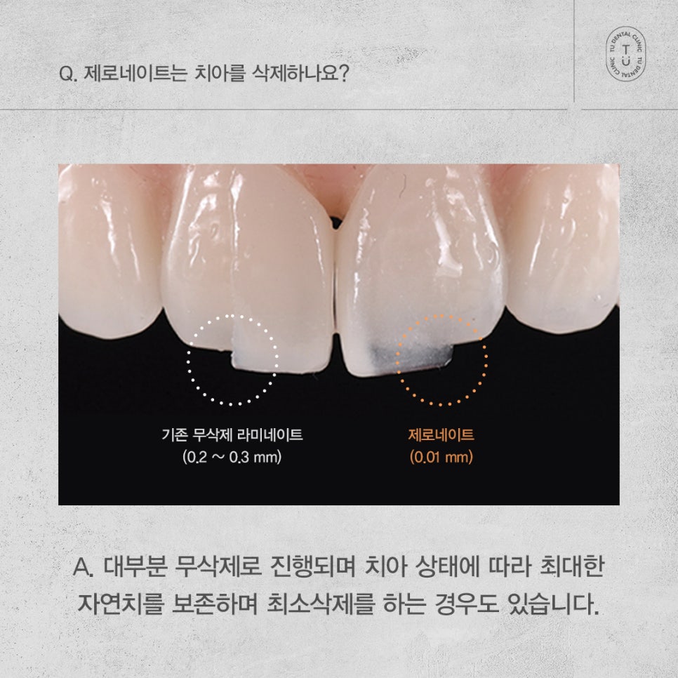 제로네이트 자주 묻는 질문 FAQ ｜ PART.1[TU치과] 관련 이미지 3