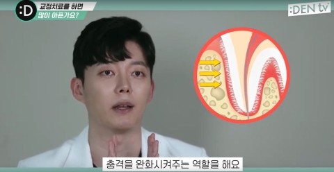 [TU치과/티유치과]치아교정하면 음식을 못씹을 정도로 아프다구?? 관련 이미지 4