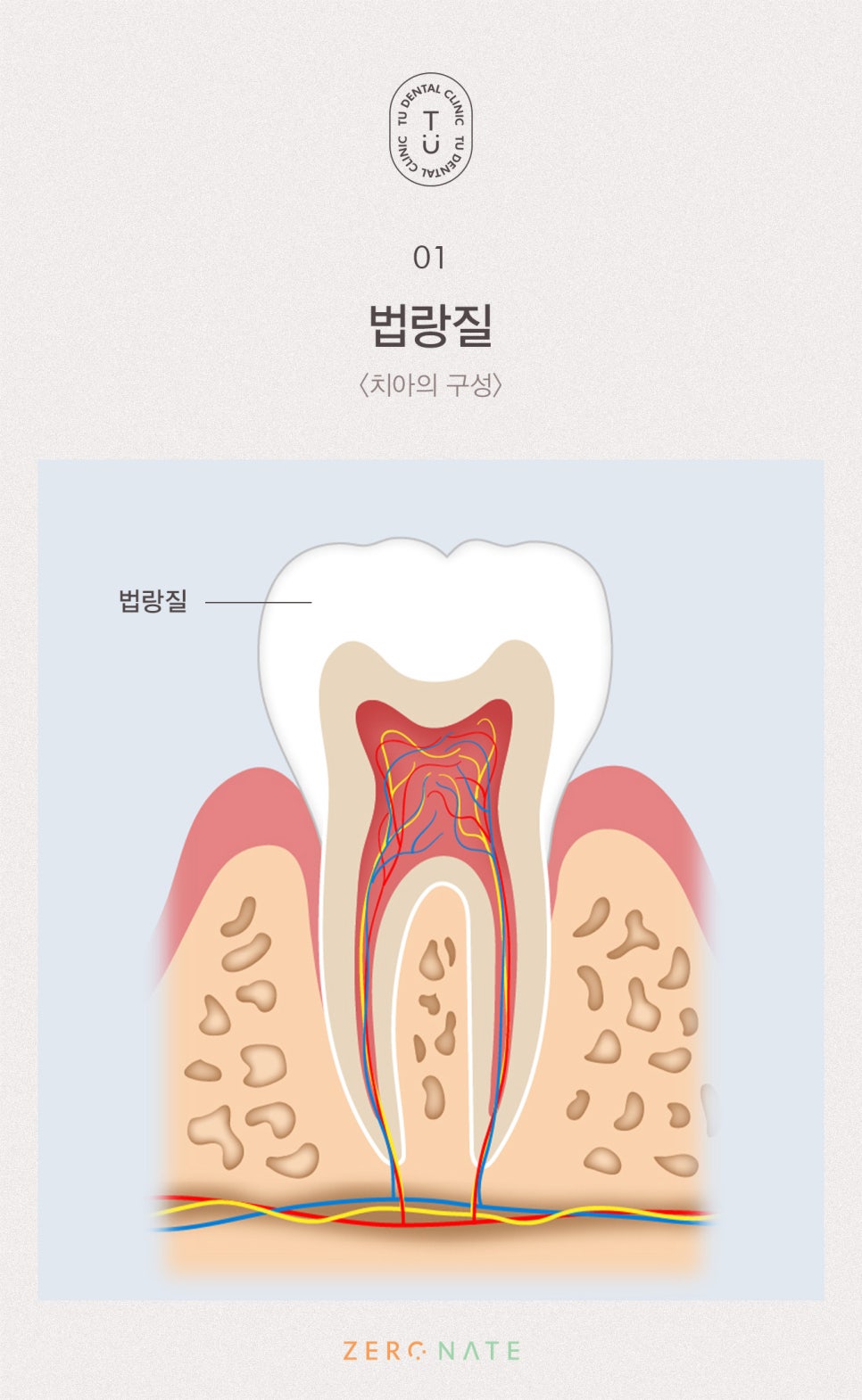 변색된 치아 치료방법, 티유치과 제로네이트 [TU치과] 관련 이미지 2