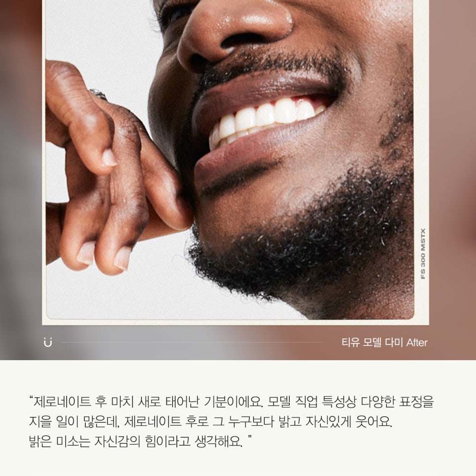 티유치과 6월 매거진, 변색된 치아의 치료법 [TU치과] 관련 이미지 6