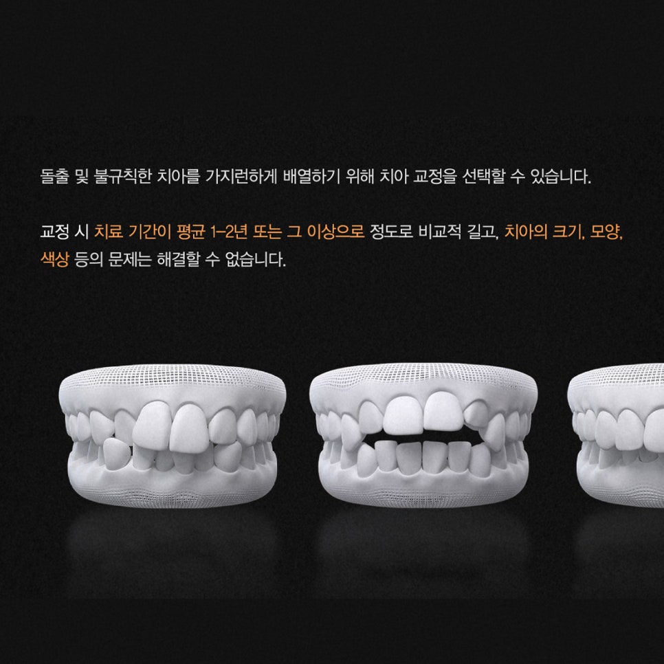 티유치과 3월 매거진 돌출, 불규칙한 치아의 치료법 [TU치과] 관련 이미지 5