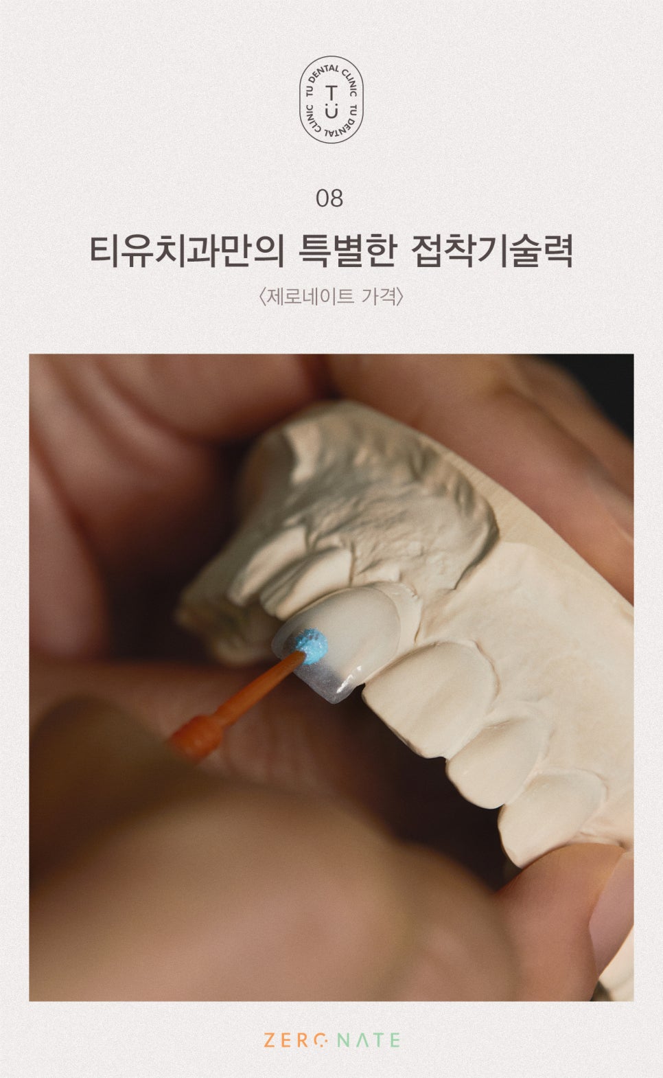 티유치과 제로네이트 가격 설명드립니다 [TU치과] 관련 이미지 9