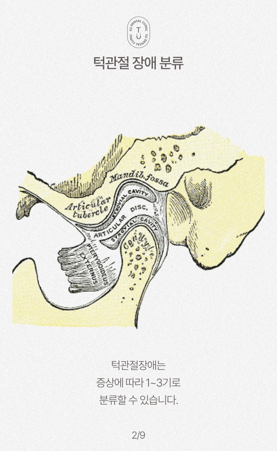 턱에서 딱 소리 나는 이유, 턱관절 장애 원인, 치료, 예방법[TU치과] 관련 이미지 3