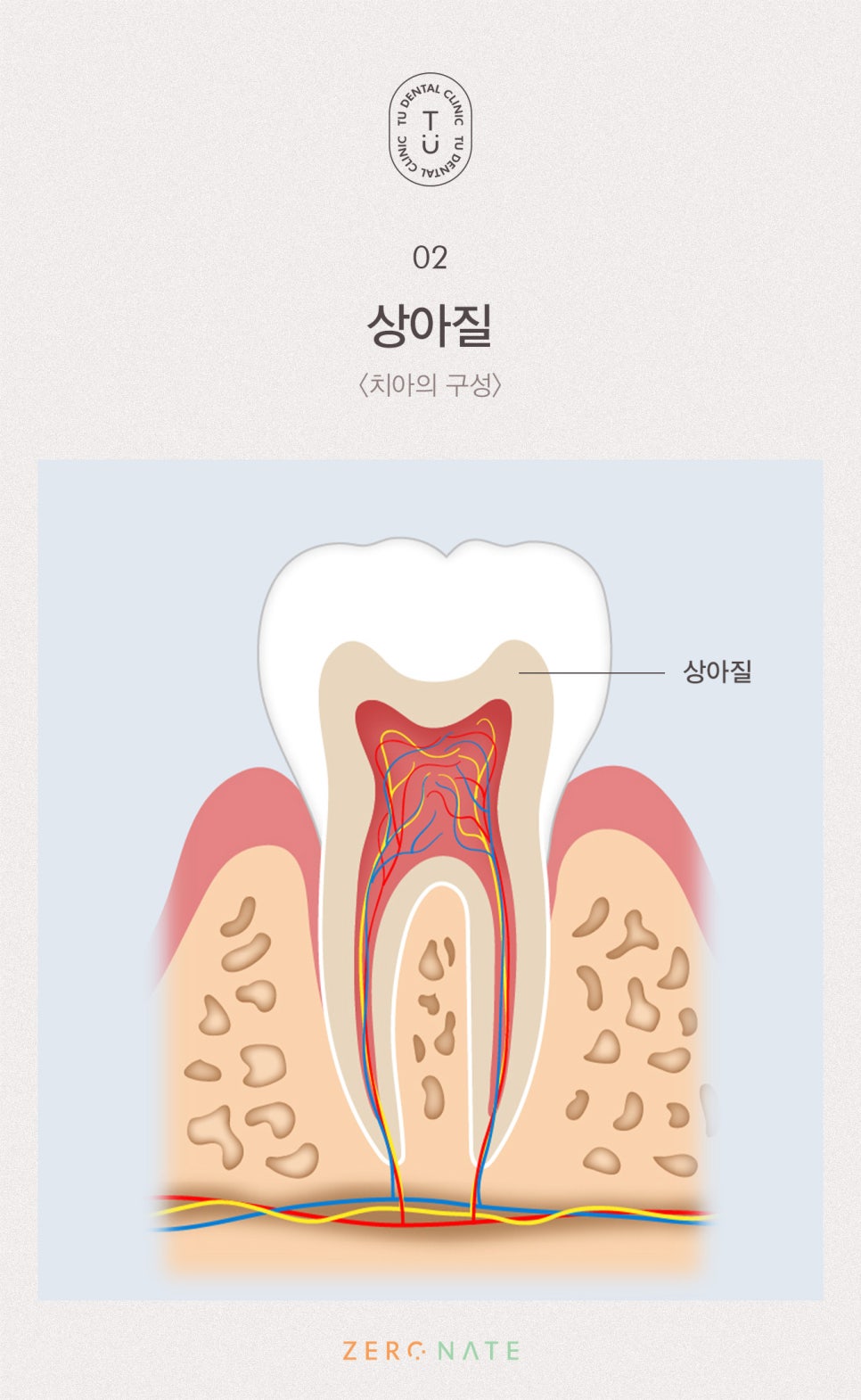 변색된 치아 치료방법, 티유치과 제로네이트 [TU치과] 관련 이미지 3