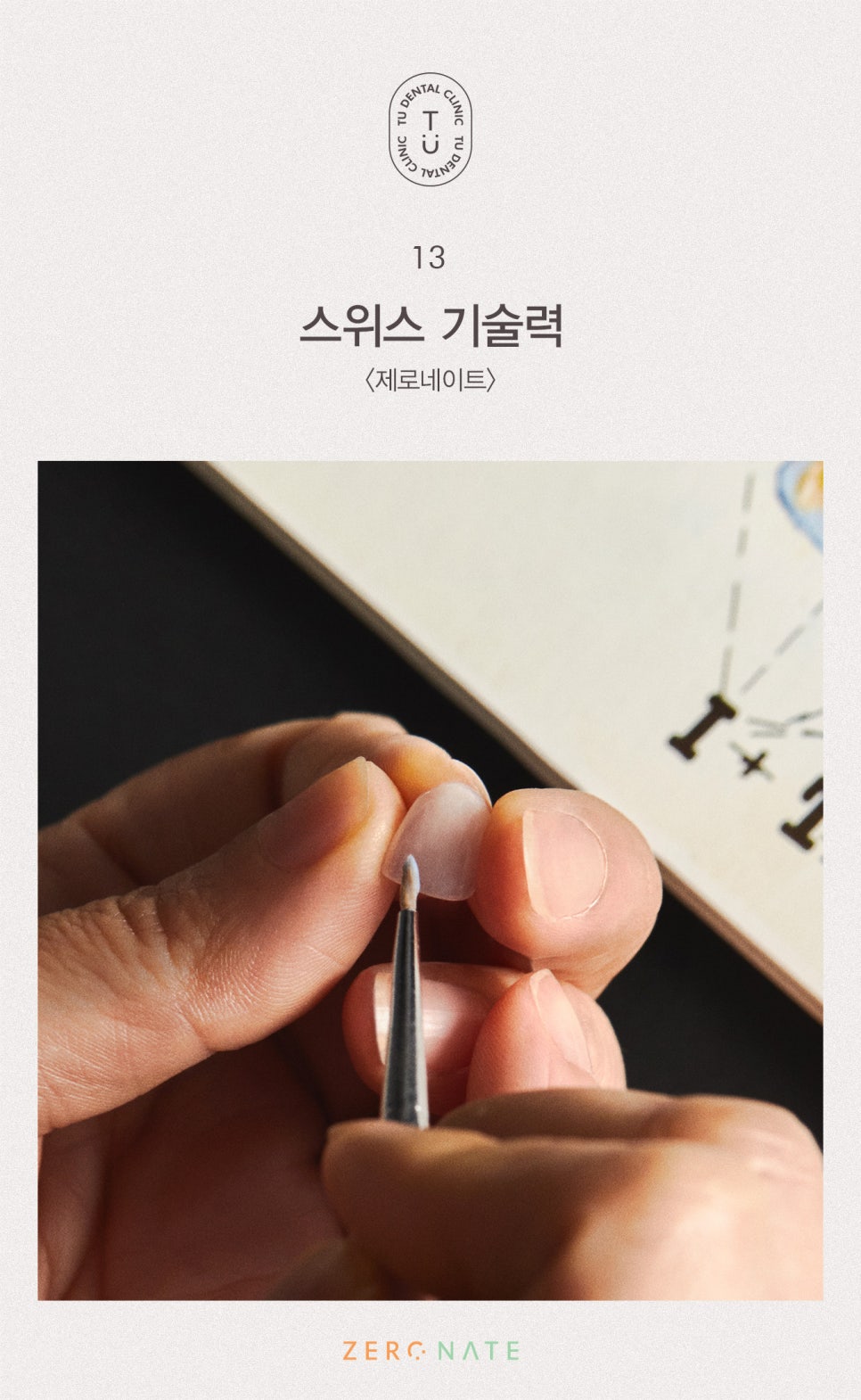 티유치과 선택적 치아 성형 [TU치과] 관련 이미지 14