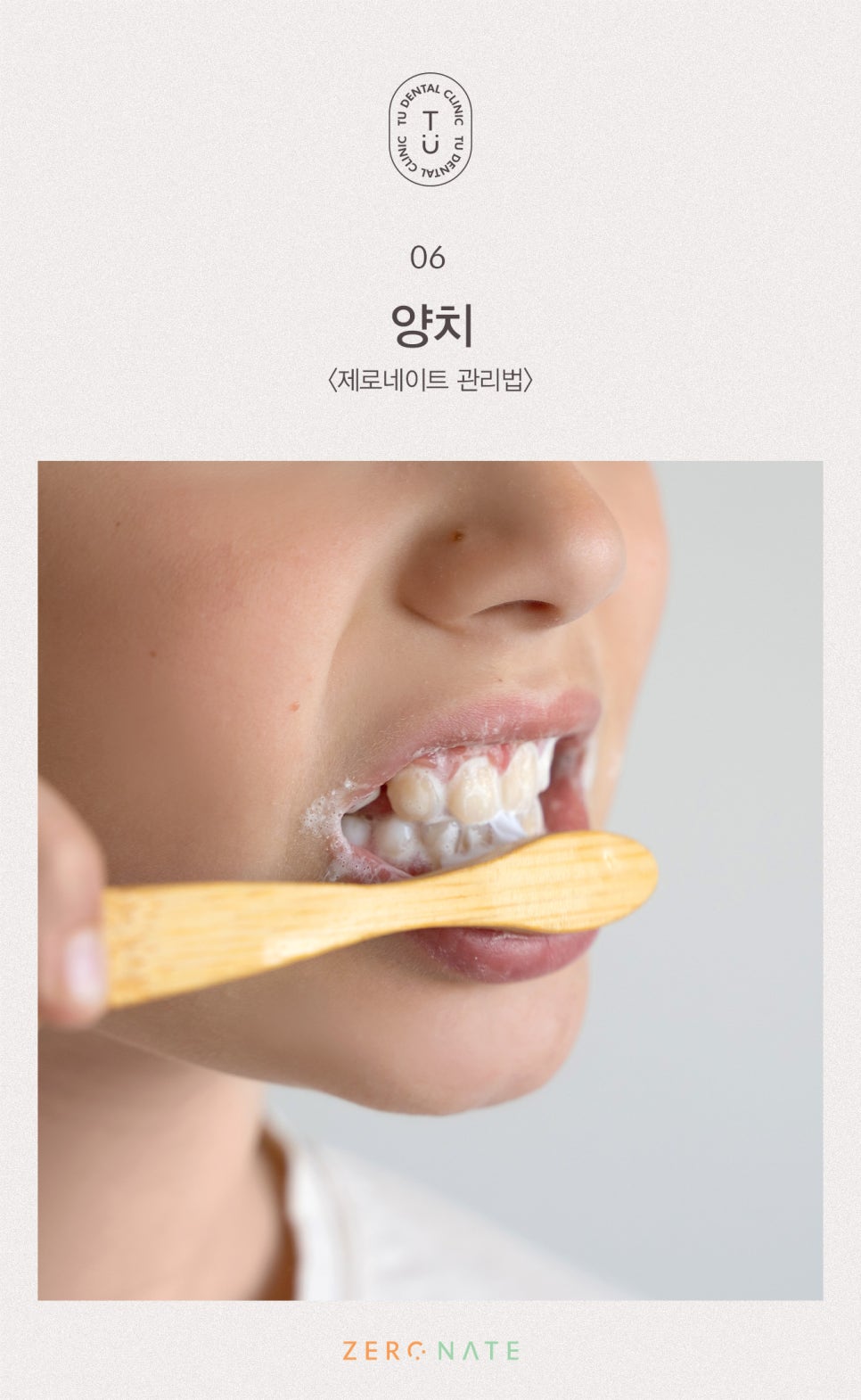 티유치과 제로네이트 관리법에 대해 알려드립니다 [TU치과] 관련 이미지 7