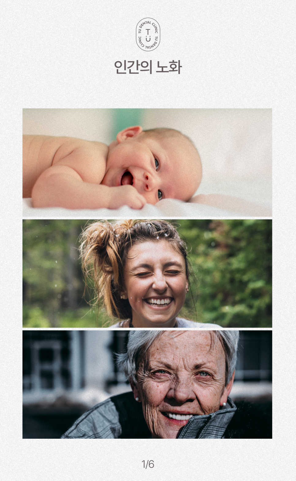 노화된 치아에 제로네이트 하세요, 티유치과[TU치과] 관련 이미지 2