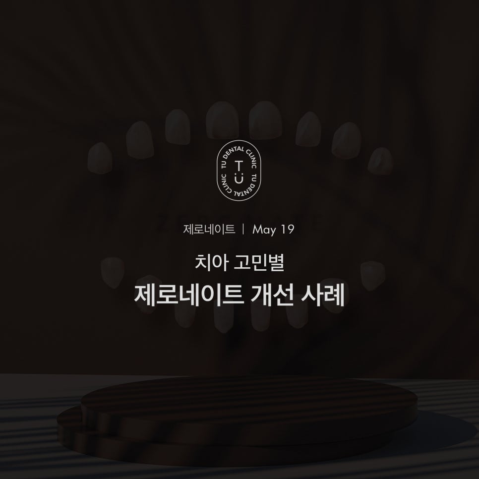 치아 고민별 제로네이트 개선 사례 (유형별 라미네이트 전후) 관련 이미지 1
