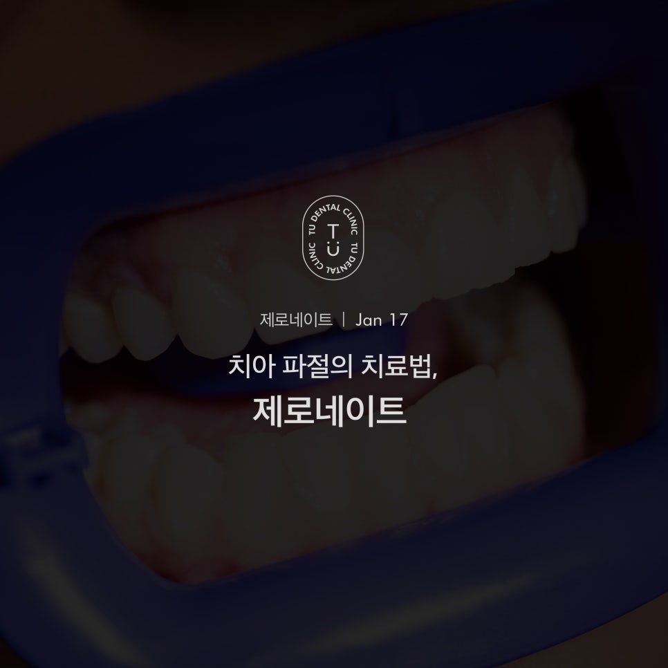 [티유치과] 치아 파절의 치료법, 제로네이트 관련 이미지 1