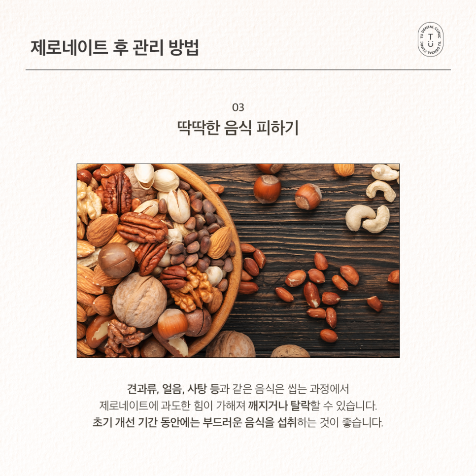 라미네이트 수명 오래가게 하려면? 제로네이트 후 치아 건강 이렇게 지키세요. 관련 이미지 4