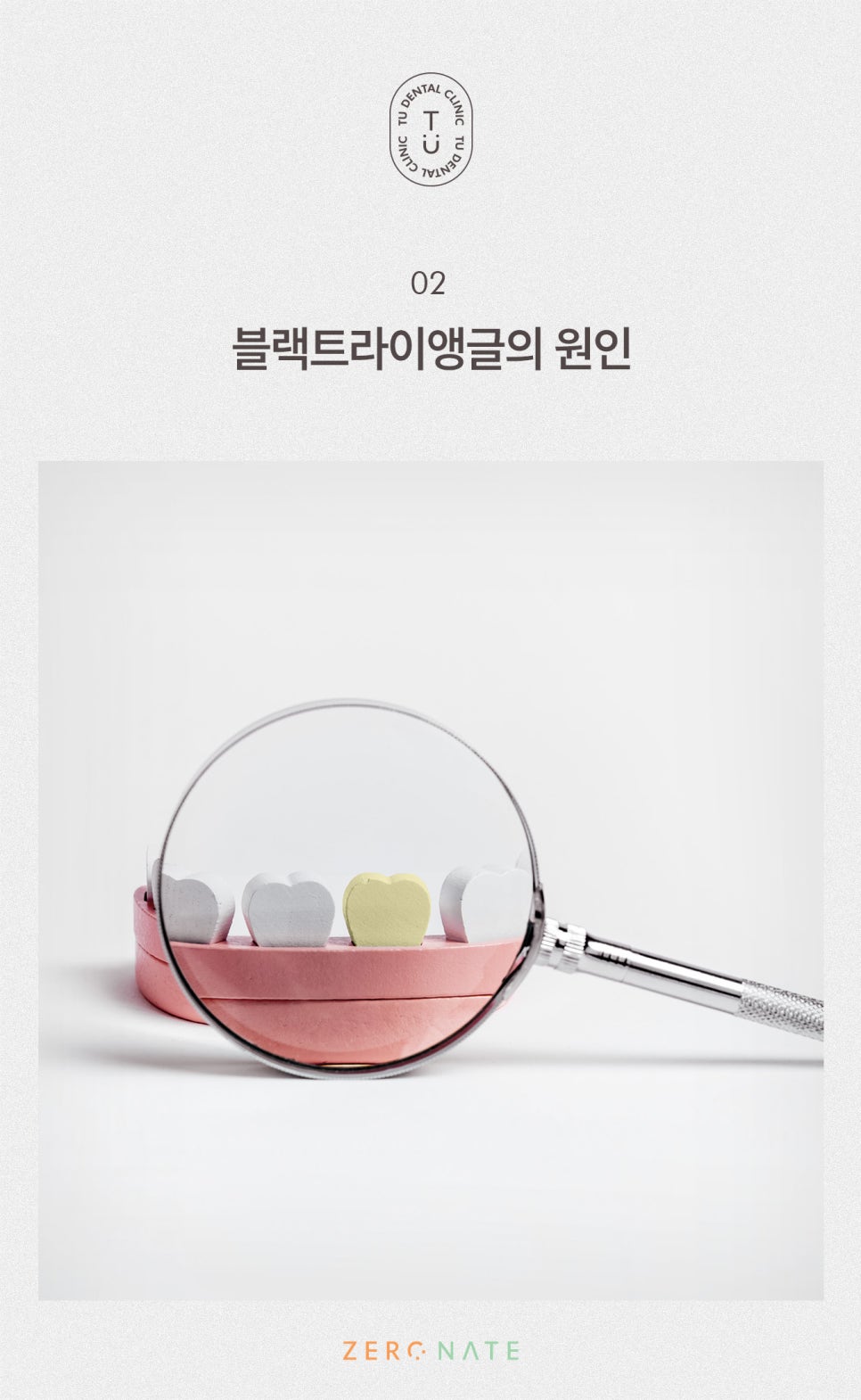 티유치과 블랙트라이앵글 제로네이트 [TU치과] 관련 이미지 3