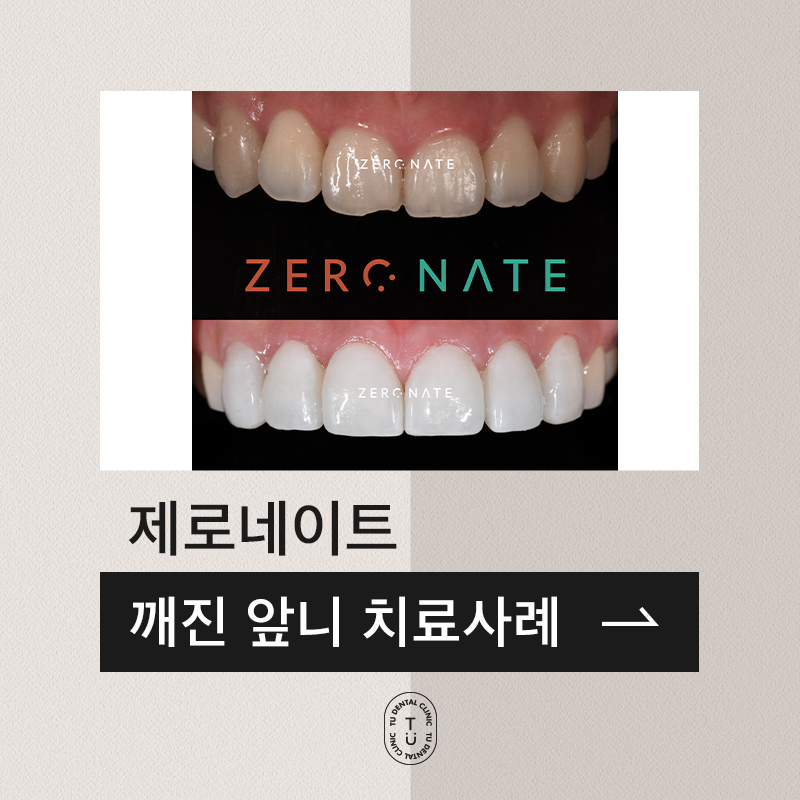 깨진 앞니 치료 제로네이트 사례 : 티유치과 관련 이미지 1