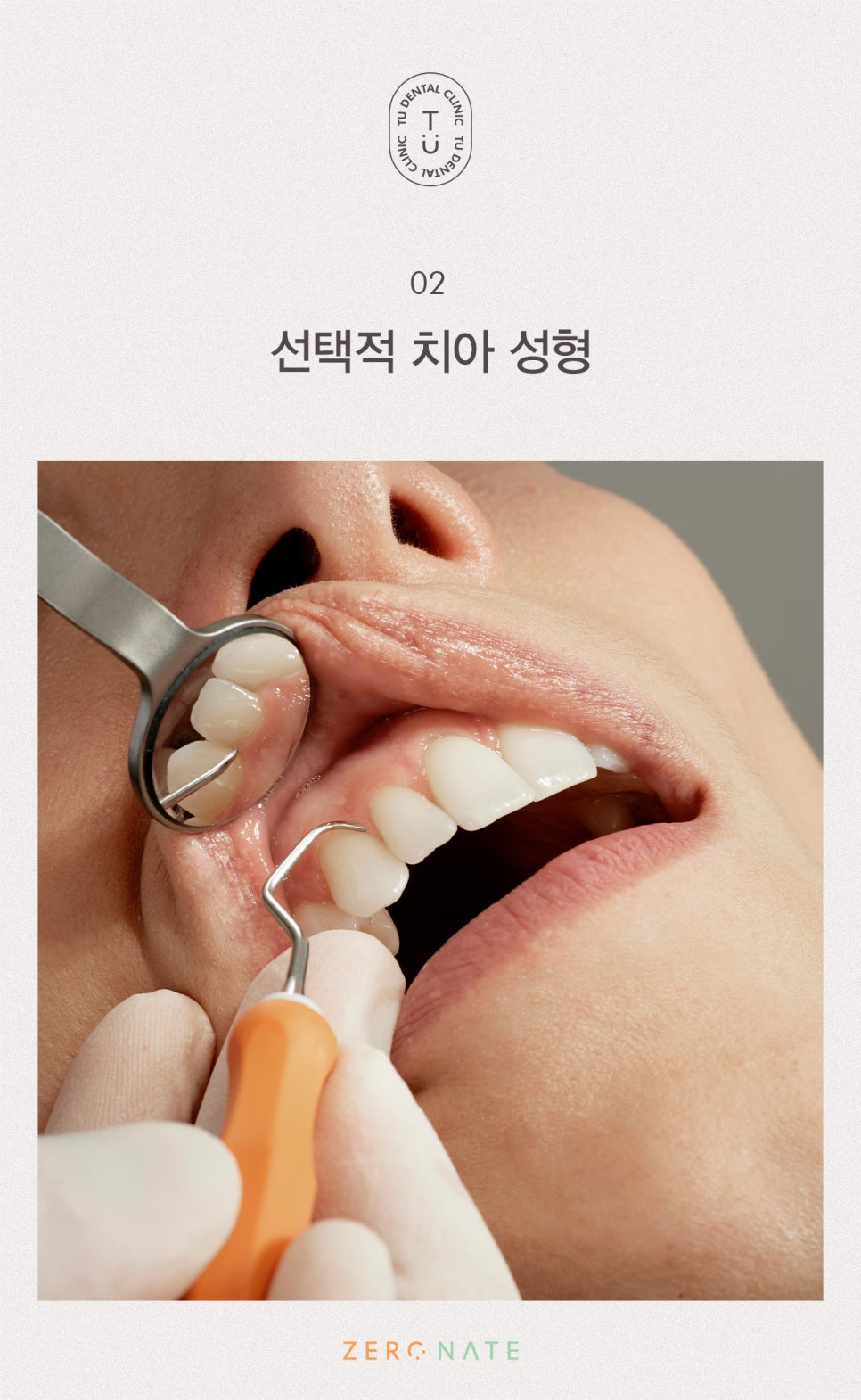 티유치과 선택적 치아 성형 [TU치과] 관련 이미지 3