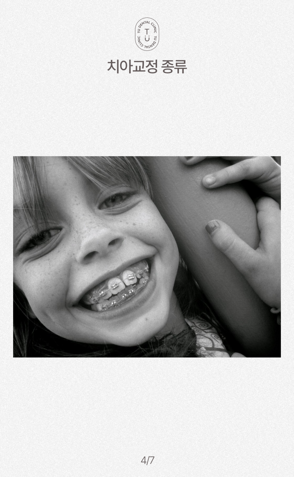 철도의 날, 삐뚤빼뚤한 치아에 철도공사하세요! 티유치과[TU치과] 관련 이미지 5