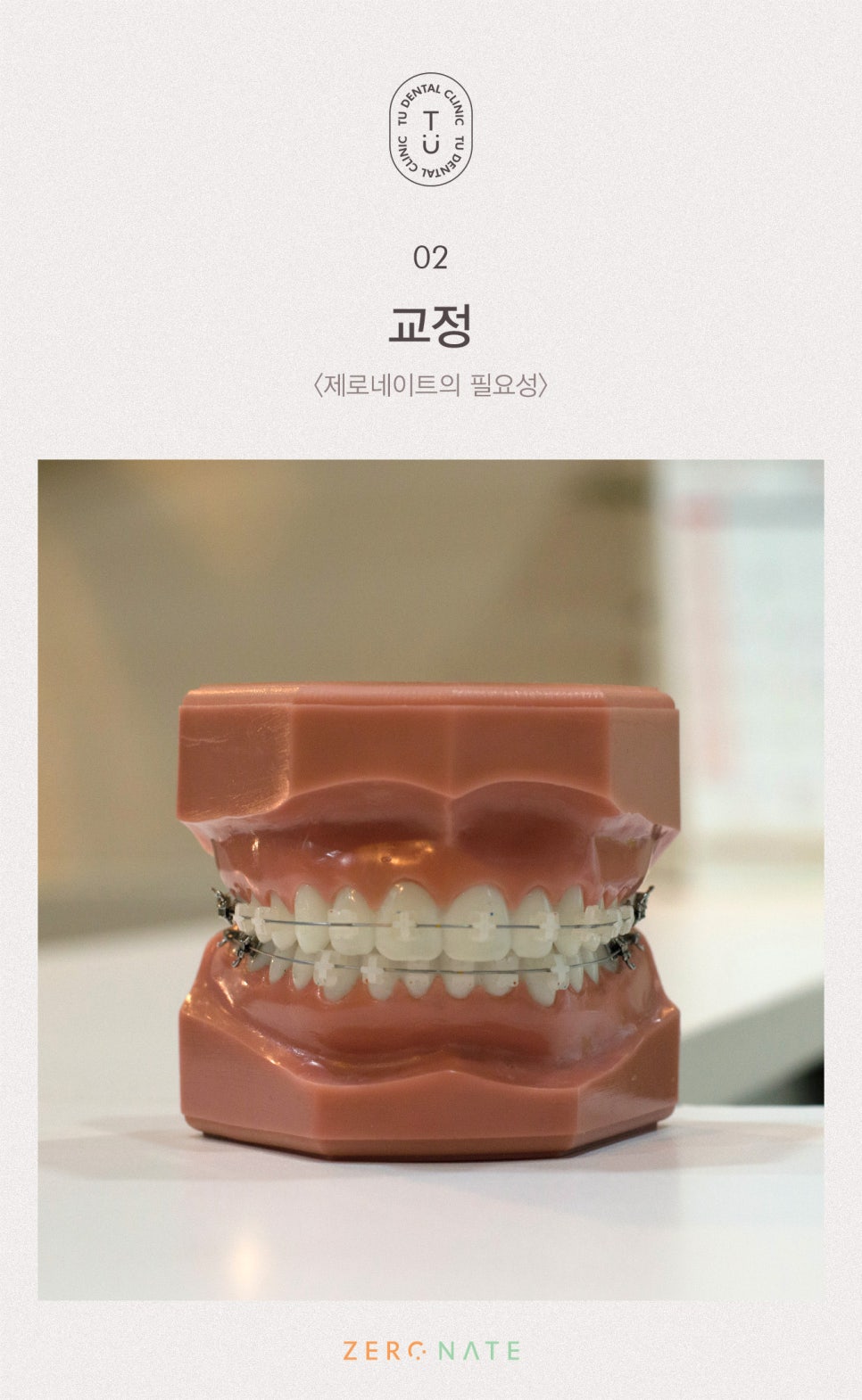 티유치과 제로네이트 부작용에 대해 설명드립니다 [TU치과] 관련 이미지 3