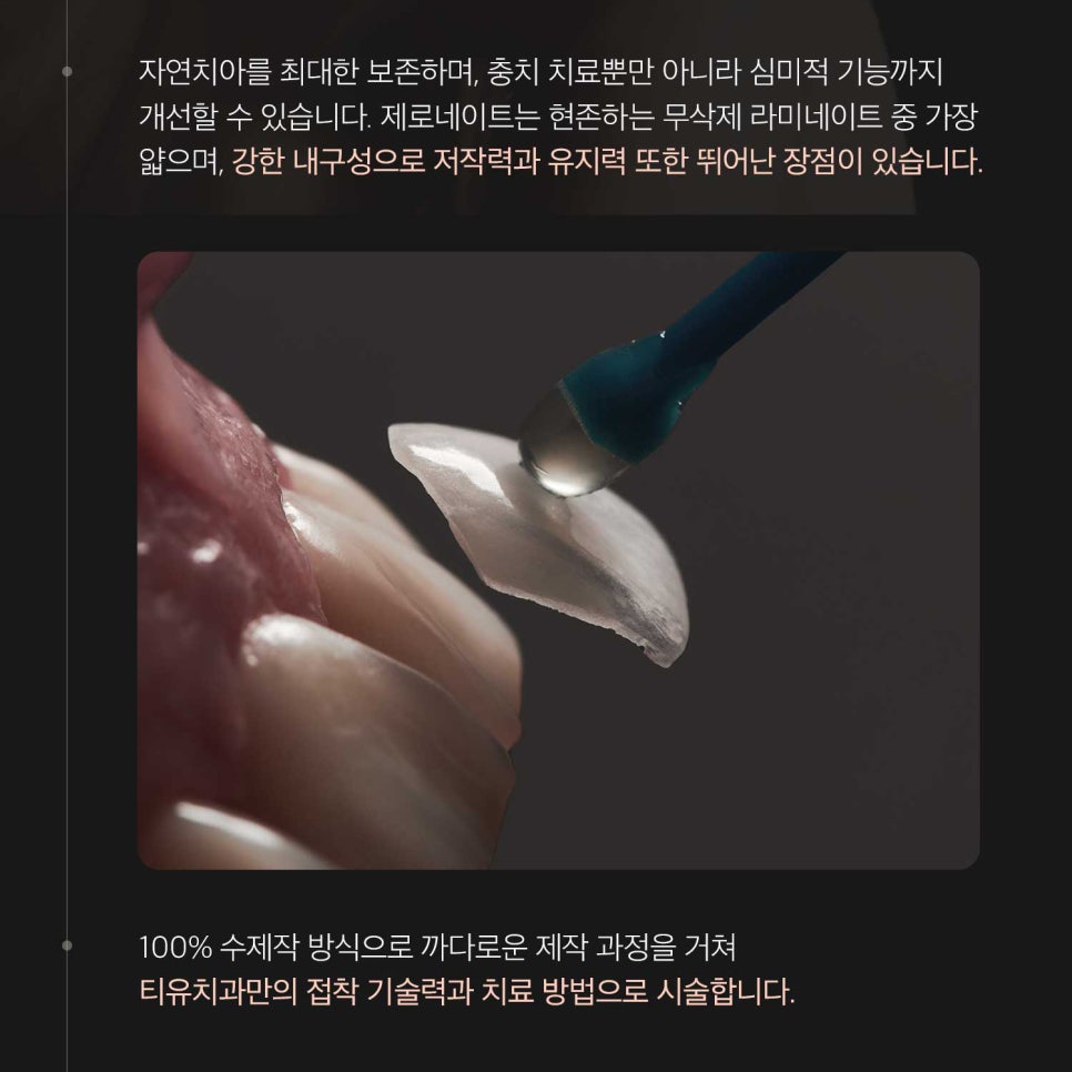 티유치과 9월 매거진, 앞니 충치의 개선, 제로네이트[TU치과] 관련 이미지 5