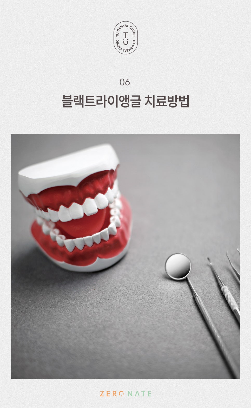 티유치과 블랙트라이앵글 제로네이트 [TU치과] 관련 이미지 7