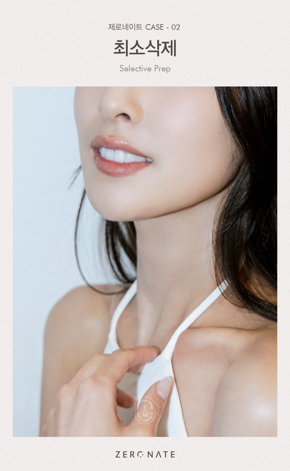 티유치과 제로네이트가 무삭제로 가능한 이유 알려드립니다 [TU치과] 관련 이미지 7