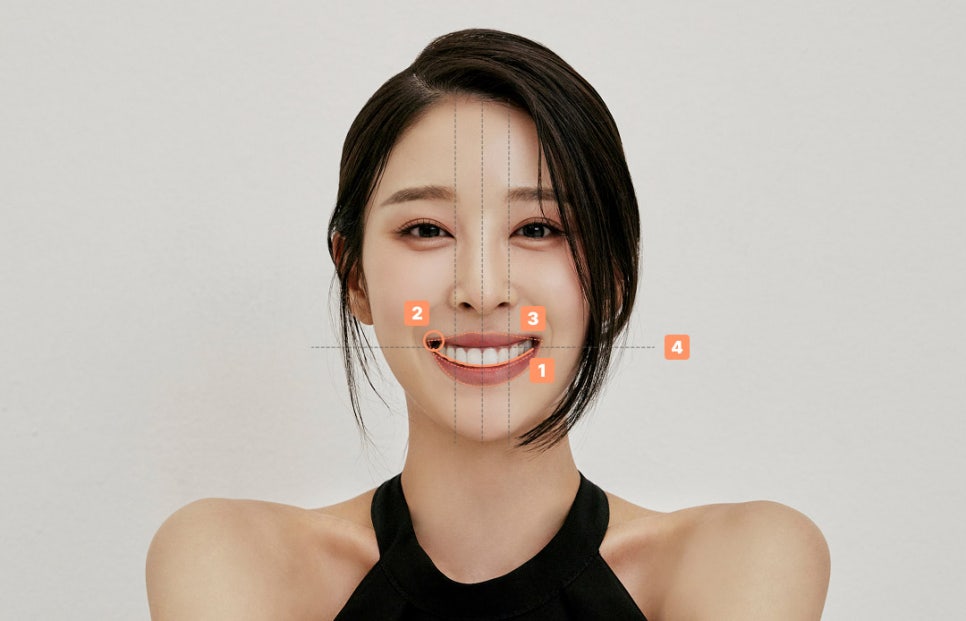 라미네이트 자연스러운 미소를 만드는 비율의 차이 관련 이미지 4