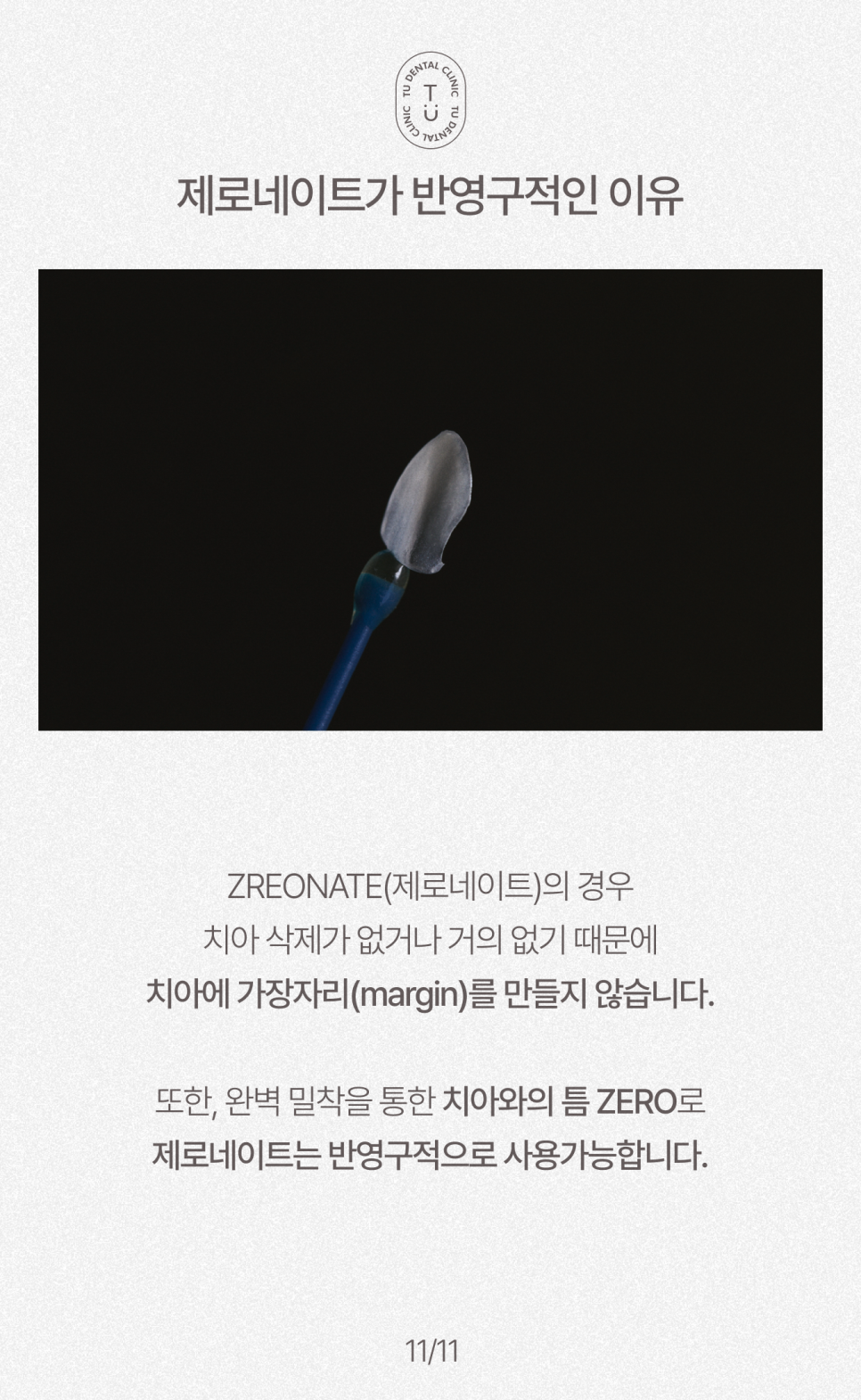 오래된 라미네이트 교체하셔야 됩니다, 티유치과[TU치과] 관련 이미지 12