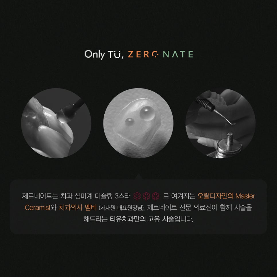티유치과 4월 매거진, 블랙트라이앵글 치아의 치료법 [TU치과] 관련 이미지 8