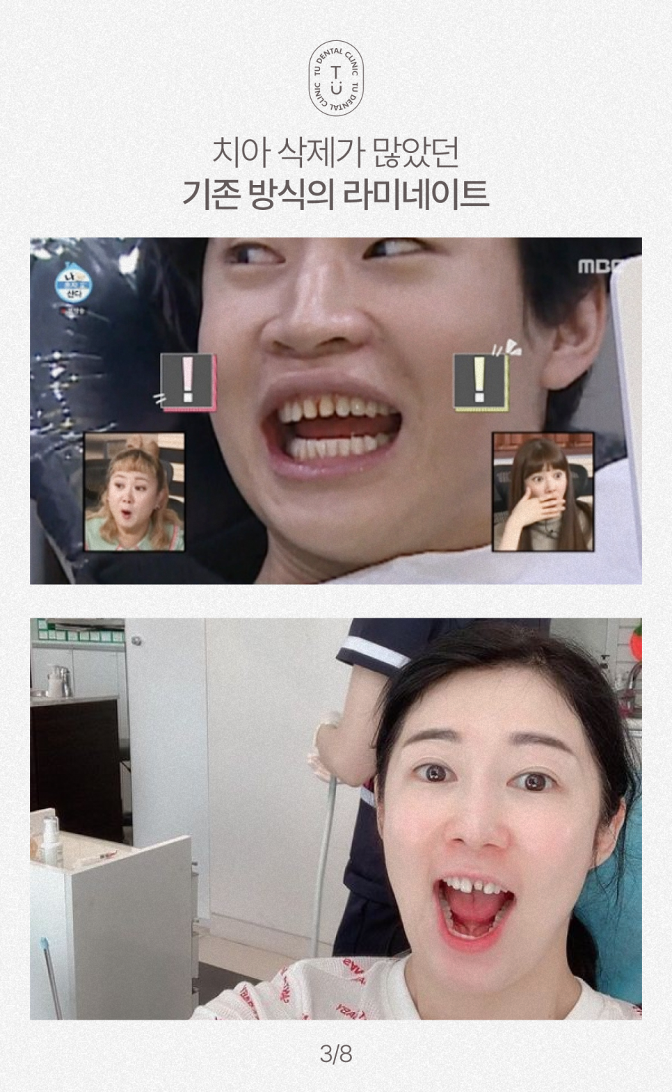 청년의 날, 실제 제로네이트 한 청년들 사례, 티유치과[TU치과] 관련 이미지 4