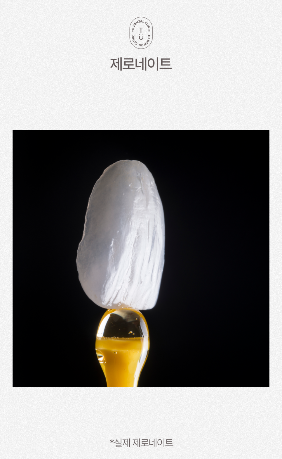 기안84 라미네이트 바로 여기서 했습니다 [TU치과] 관련 이미지 9