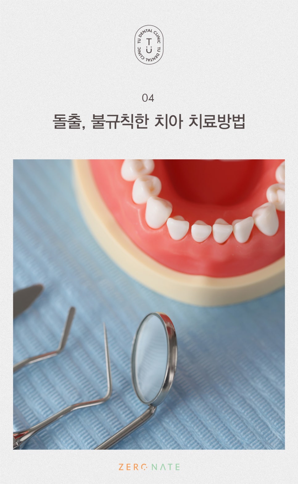 티유치과 돌출,불규칙한 치아 제로네이트[TU치과] 관련 이미지 5