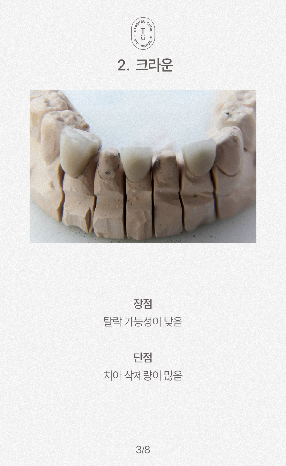 왜소치 치료방법, 작은치아 라미네이트, 제로네이트 알려드립니다! 티유치과[TU치과] 관련 이미지 4