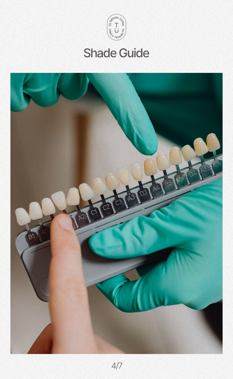 치아 반영구적으로 하얘지는 법, 티유치과[TU치과] 관련 이미지 5