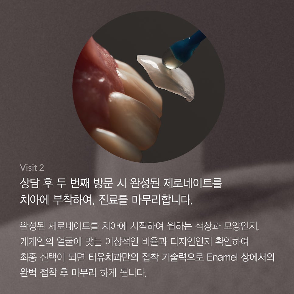 티유치과 11월 매거진, 제로네이트 시술 과정 관련 이미지 6