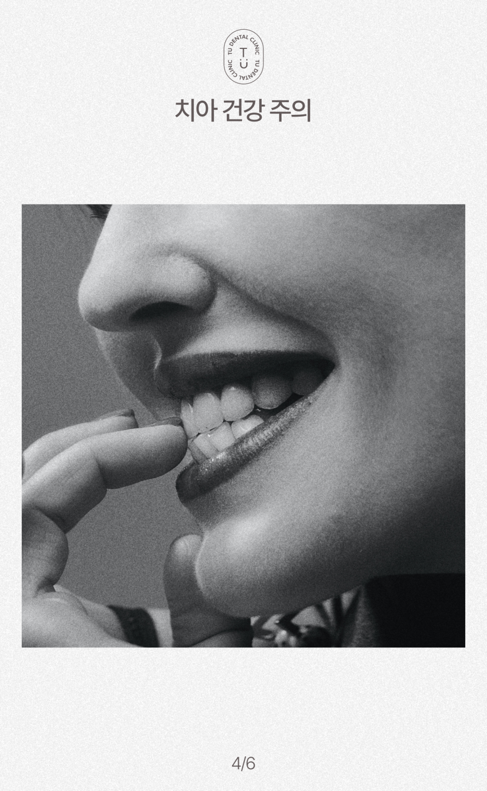 복날 삼계탕 드시기 전 구강관리법 알려드립니다, 티유치과[TU치과] 관련 이미지 5