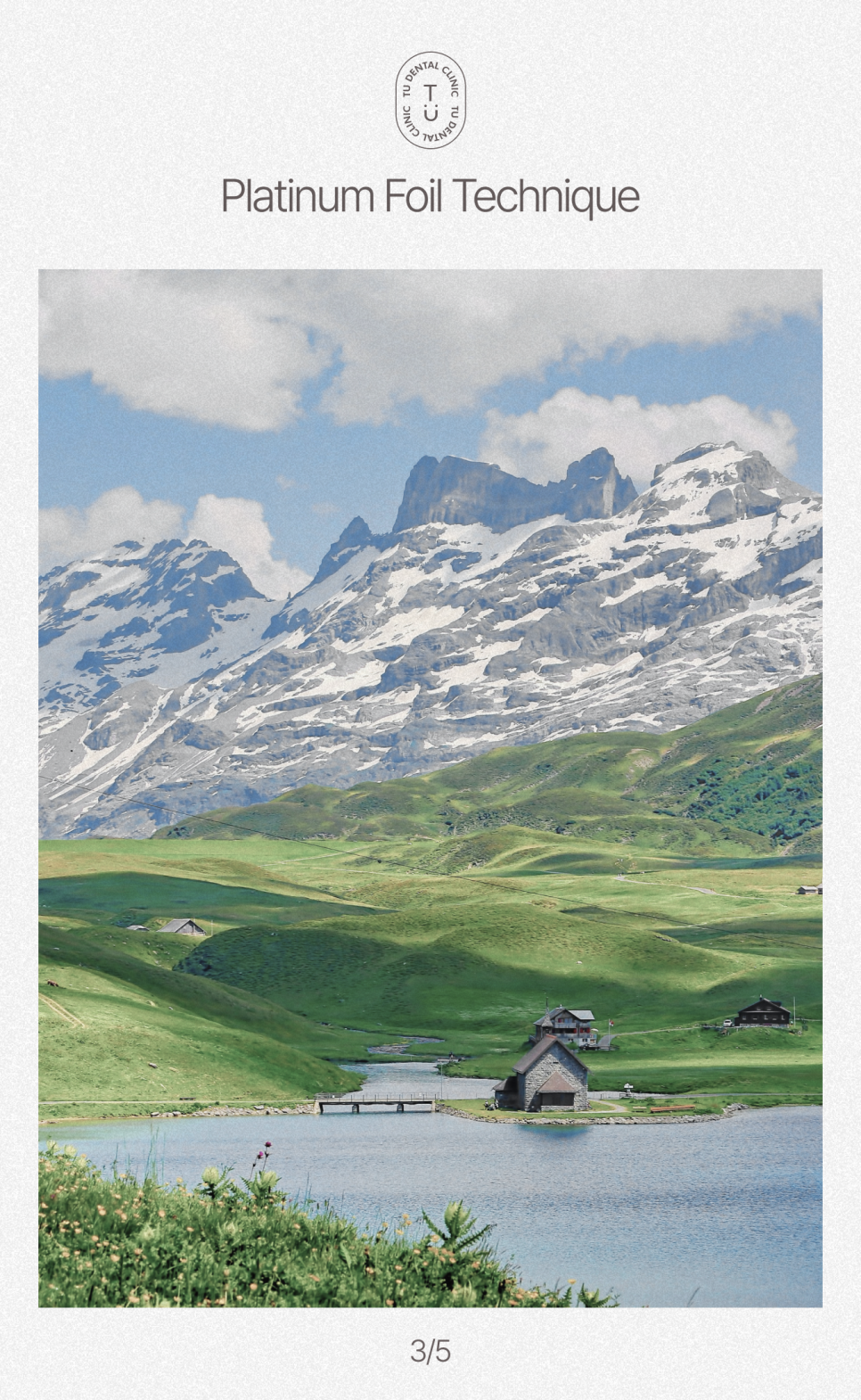 완전 무삭제 라미네이트, 제로네이트는 TU치과 [티유치과] 관련 이미지 4