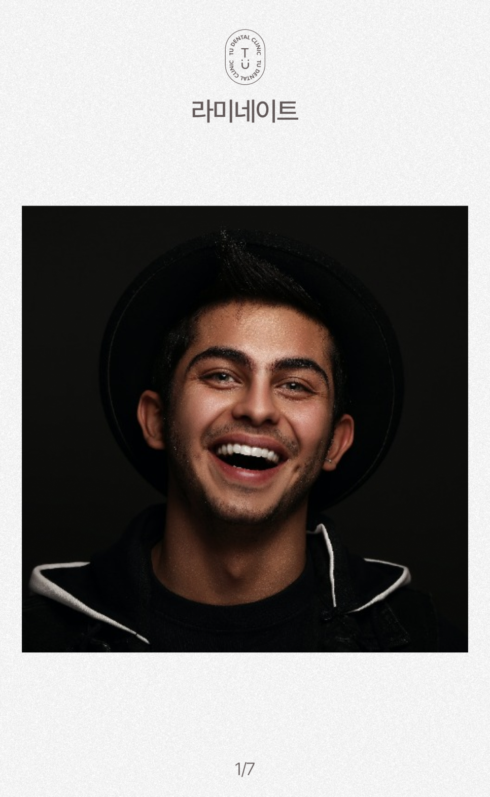 라미네이트 부작용, 떨어지는 이유 알려드립니다 관련 이미지 2