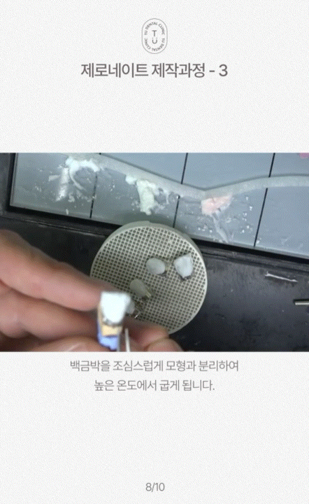 제로네이트 제작 과정 알려드립니다, 티유치과[TU치과] 관련 이미지 9