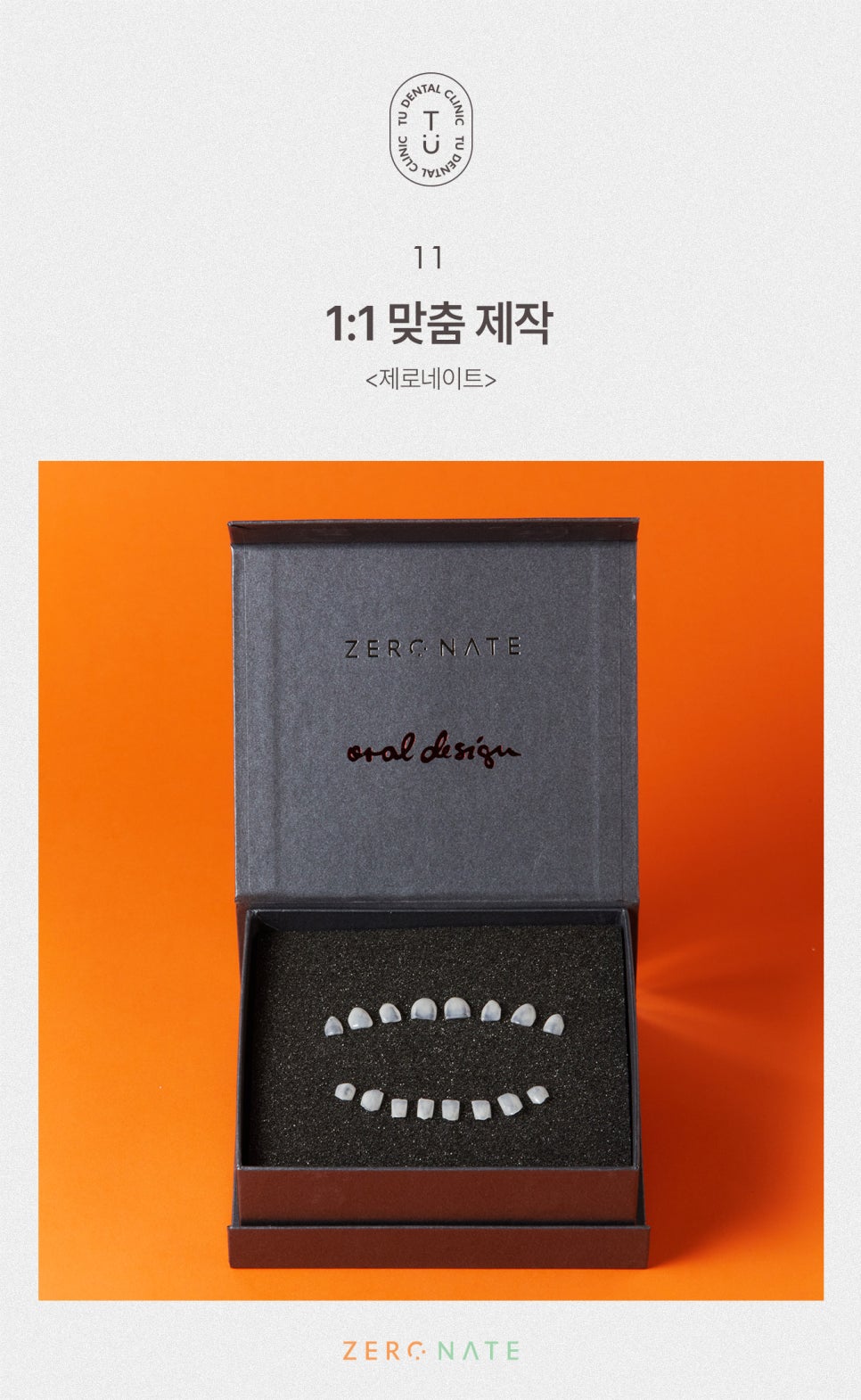 티유치과 블랙트라이앵글 제로네이트 [TU치과] 관련 이미지 12