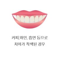 [TU치과/티유치과] 치아변색?? 치아미백으로 해결! 관련 이미지 2