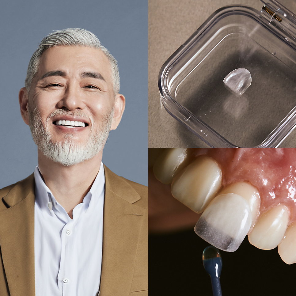 [티유치과] 안티에이징의 치료법, 제로네이트[TU치과] 관련 이미지 6