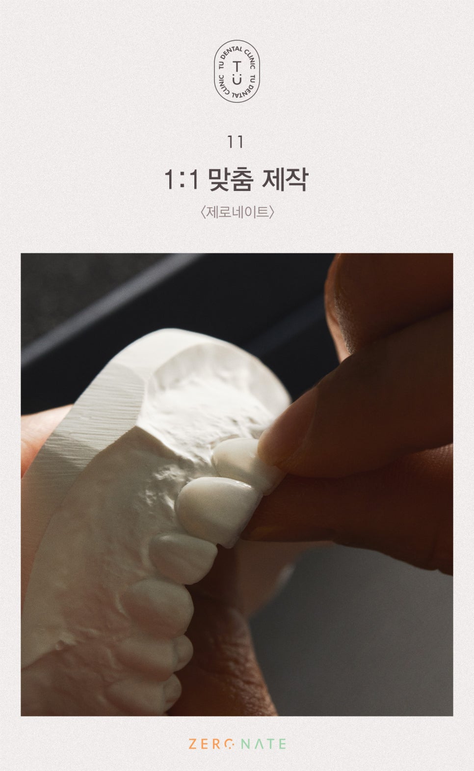 변색된 치아 치료방법, 티유치과 제로네이트 [TU치과] 관련 이미지 12