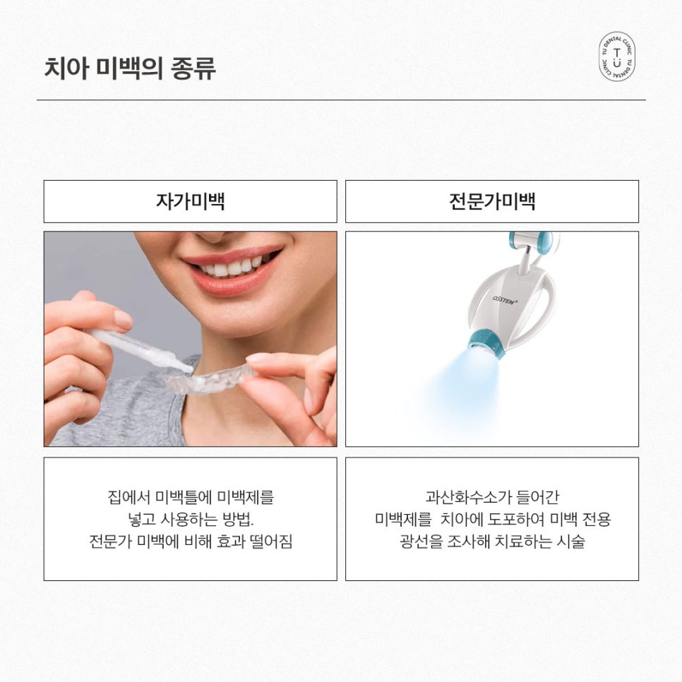 [티유치과] 치아미백으로 해결되지 않는 변색 치아의 치료법, 제로네이트 관련 이미지 4