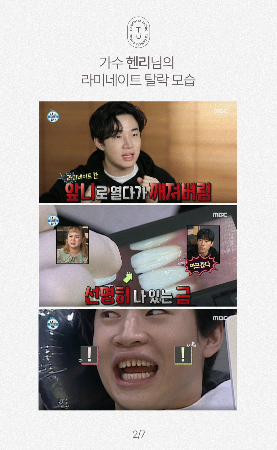 라미네이트 부작용, 떨어지는 이유 알려드립니다 관련 이미지 3