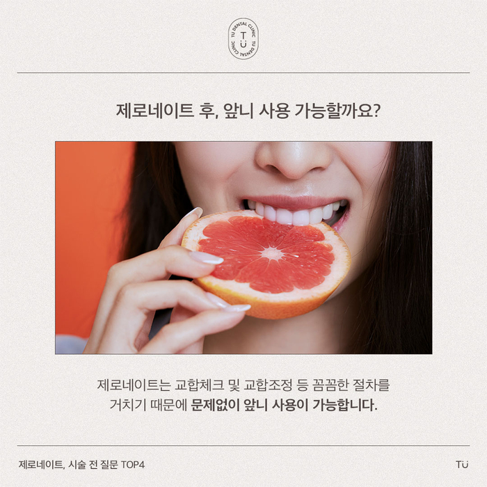 [티유치과] 제로네이트, 시술 전 질문 TOP4 [TU치과] 관련 이미지 5