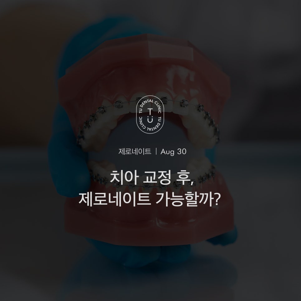 [티유치과] 치아 교정 후, 제로네이트 가능할까요?[TU치과] 관련 이미지 1