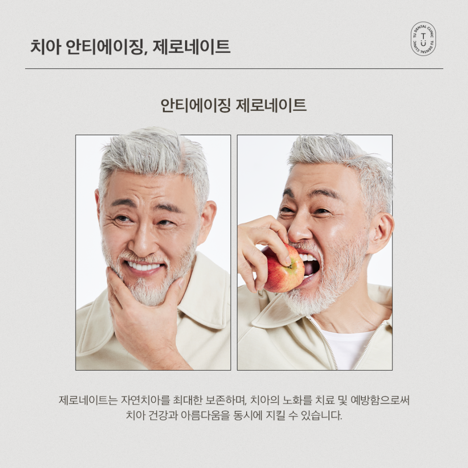 [티유치과] 안티에이징의 치료법, 제로네이트[TU치과] 관련 이미지 4
