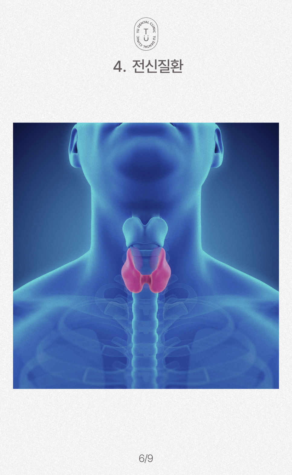 턱에서 딱 소리 나는 이유, 턱관절 장애 원인, 치료, 예방법[TU치과] 관련 이미지 7