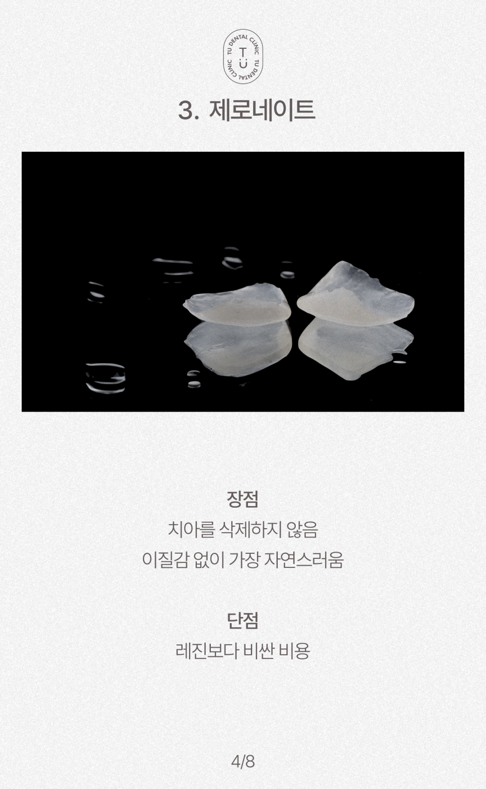 왜소치 치료방법, 작은치아 라미네이트, 제로네이트 알려드립니다! 티유치과[TU치과] 관련 이미지 5